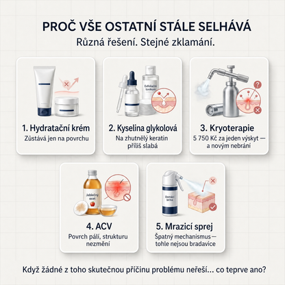 Zlerima — Pokročilý Keratolytický Krém na Drsné, Vystouplé Seboroické Keratózy